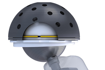 Hip Replacement 2