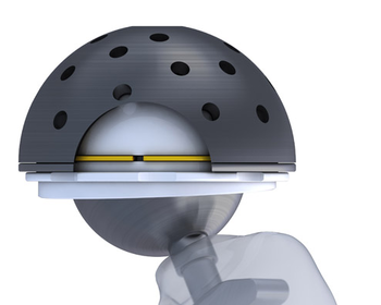 Hip Replacement 2
