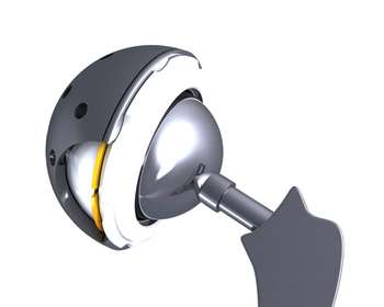 Hip Replacement 4